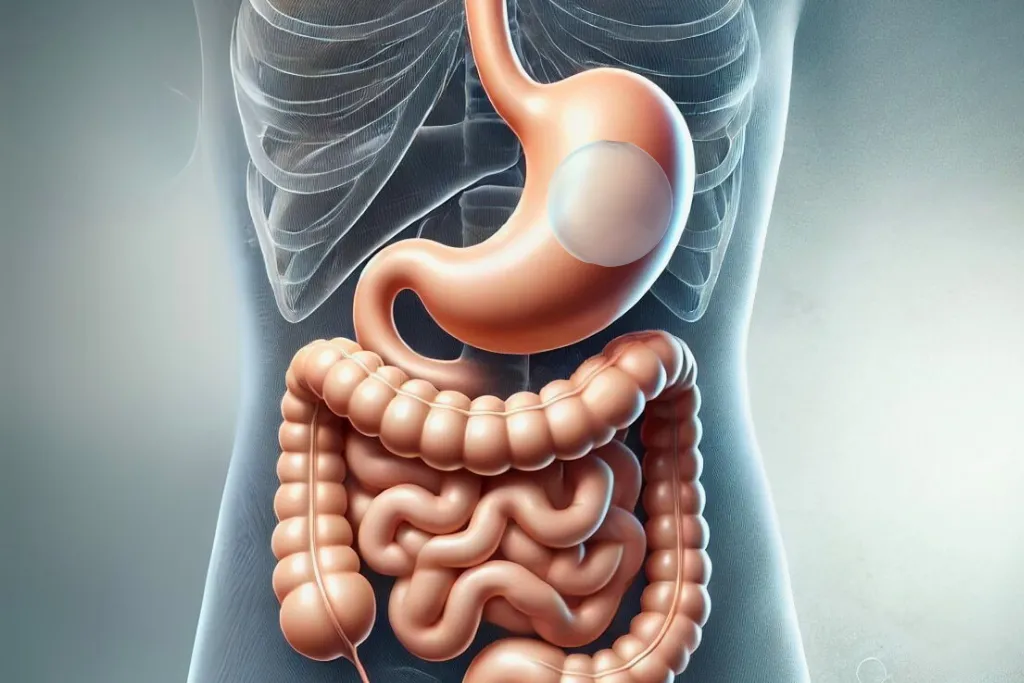 Gastric Balloon Before and After: What to Expect on Your Journey