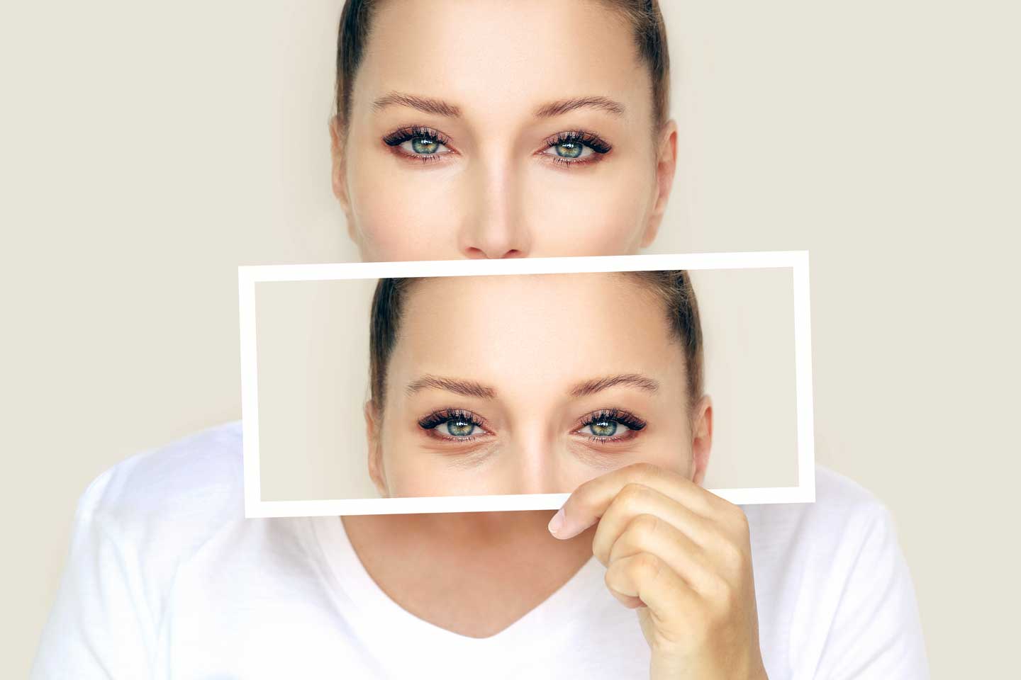 Blepharoplasty Recovery Timeline: Week-by-Week Healing Process