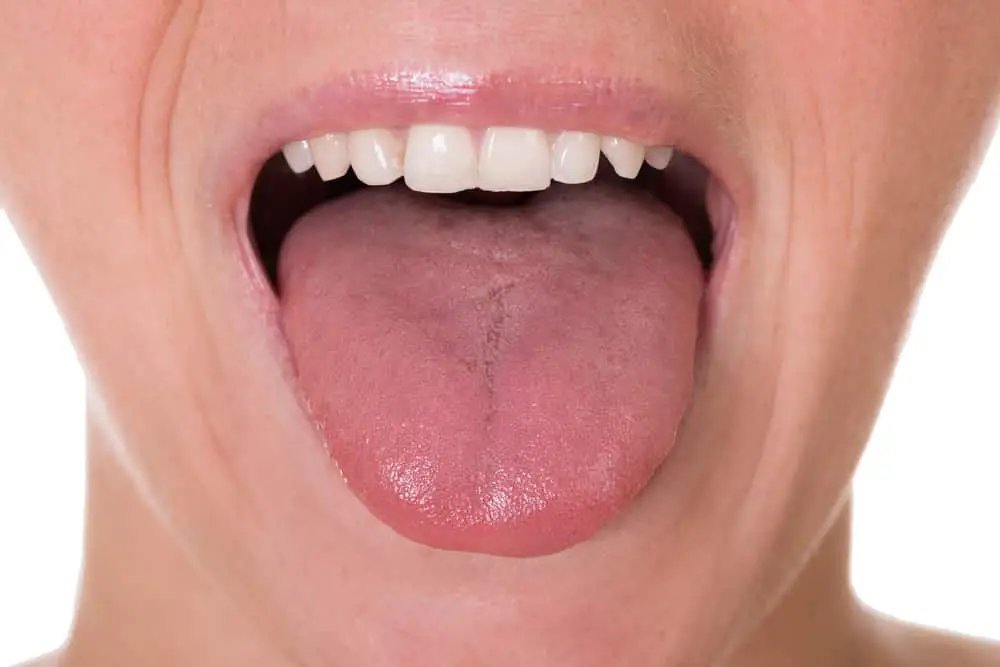 What Does a Healthy Tongue Look Like?