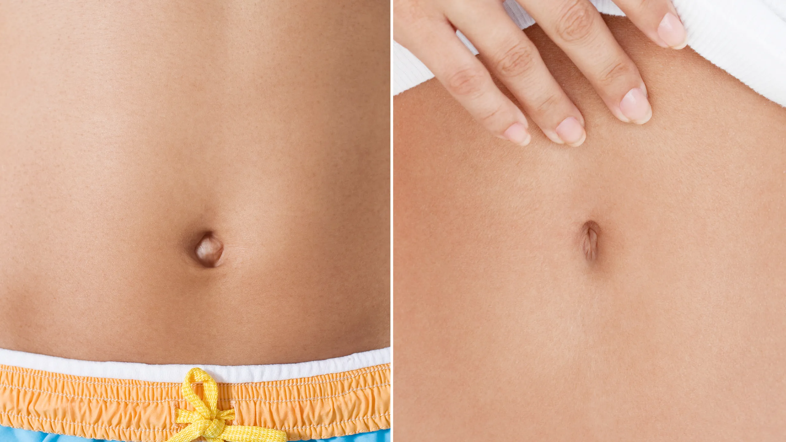 Belly Button Plastic Surgery