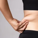 Fat Freezing