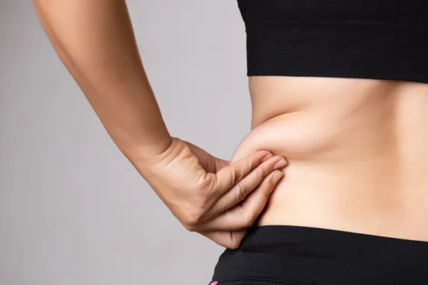 Fat Freezing