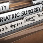 Most Popular Weight Loss Surgeries