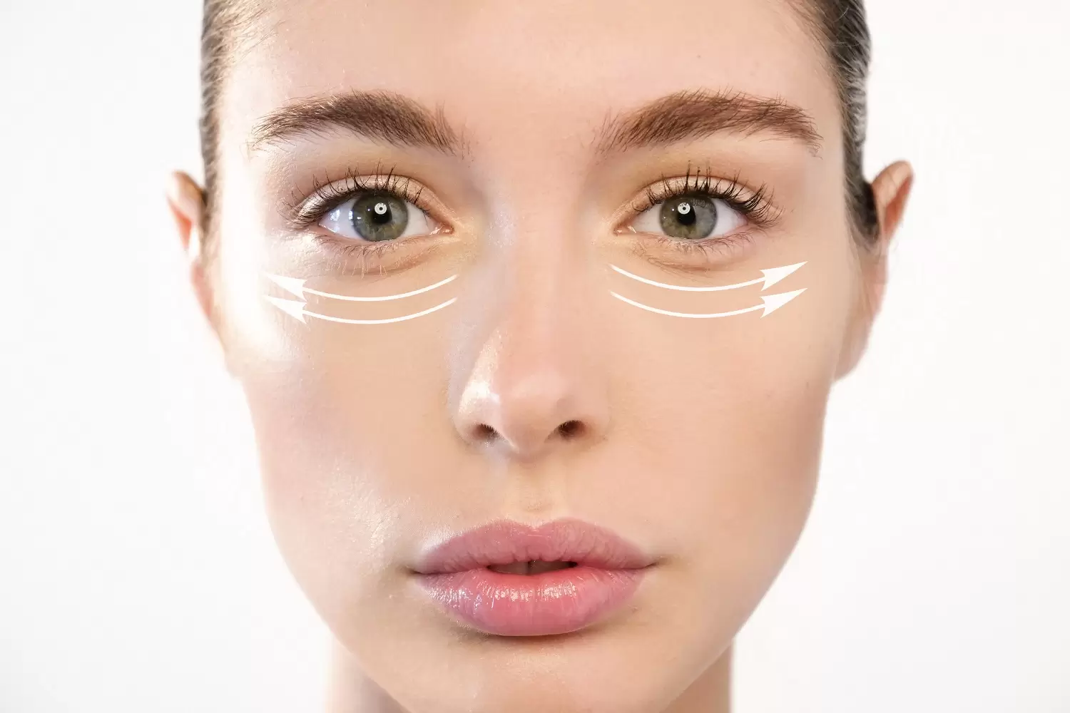 Under Eye Bag Removal