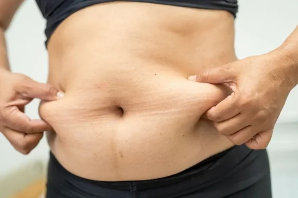Gastriv Sleeve Recovery