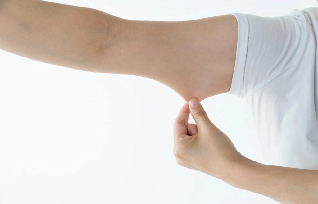 Loose Bicep Skin Solutions: From Muscle Building to Surgery