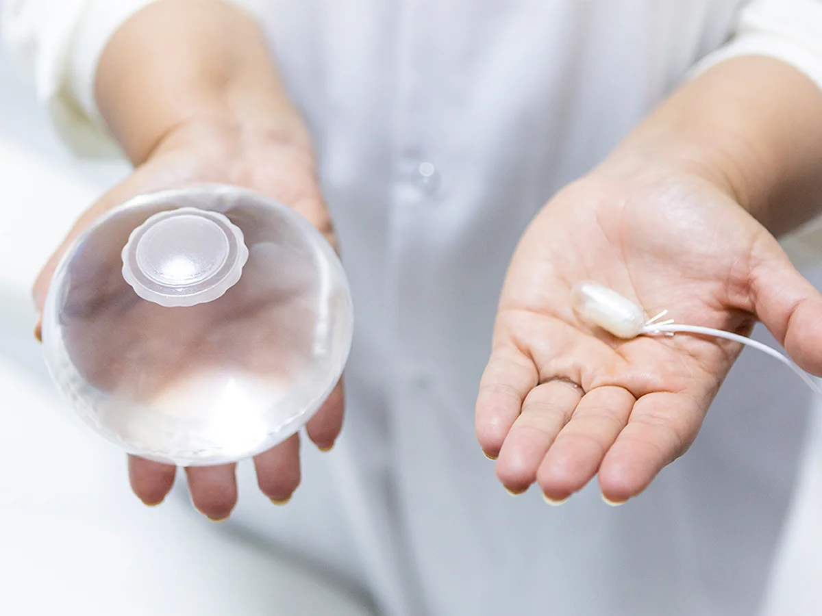 Swallowable Gastric Balloons for Weight Loss: Process and Results
