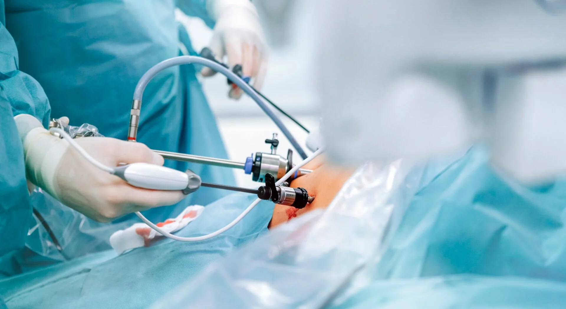 Turkey Weight Loss Surgery: Complications, Risks and Clinic Selection