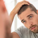 Hair Transplant Aftercare