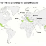 Cheapest Dental Implant Countries