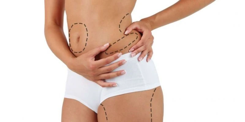 Liposuction Risks