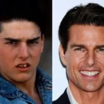 Tom Cruise's Teeth