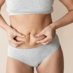 Tummy Tuck Complications