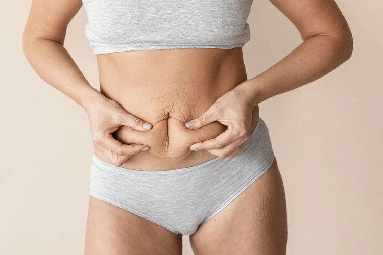 Tummy Tuck Complications