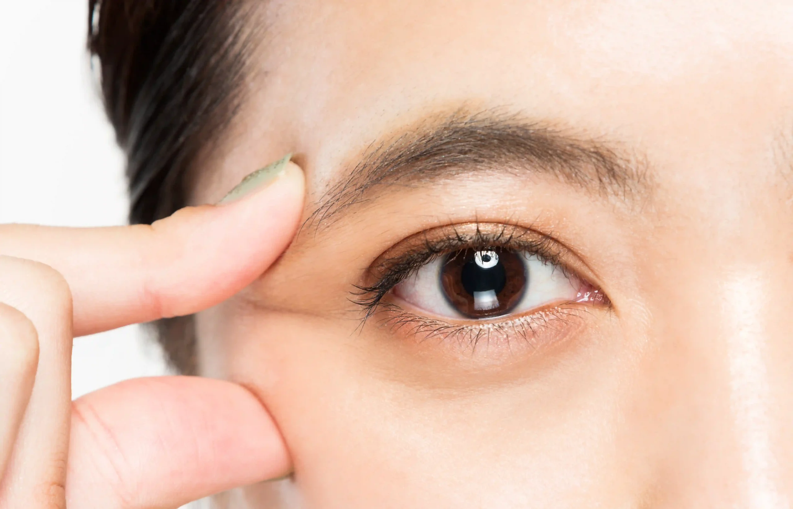 Uneven Eyelids