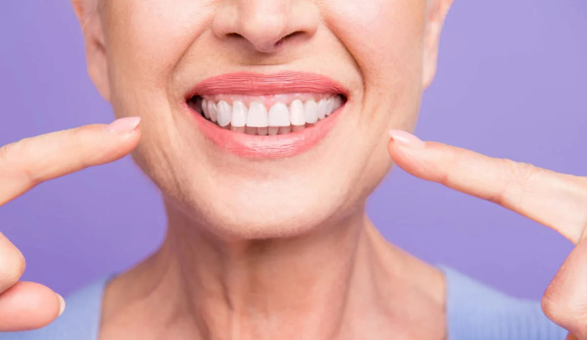 Gummy Smile: Causes, Treatment Options and Recovery Guide