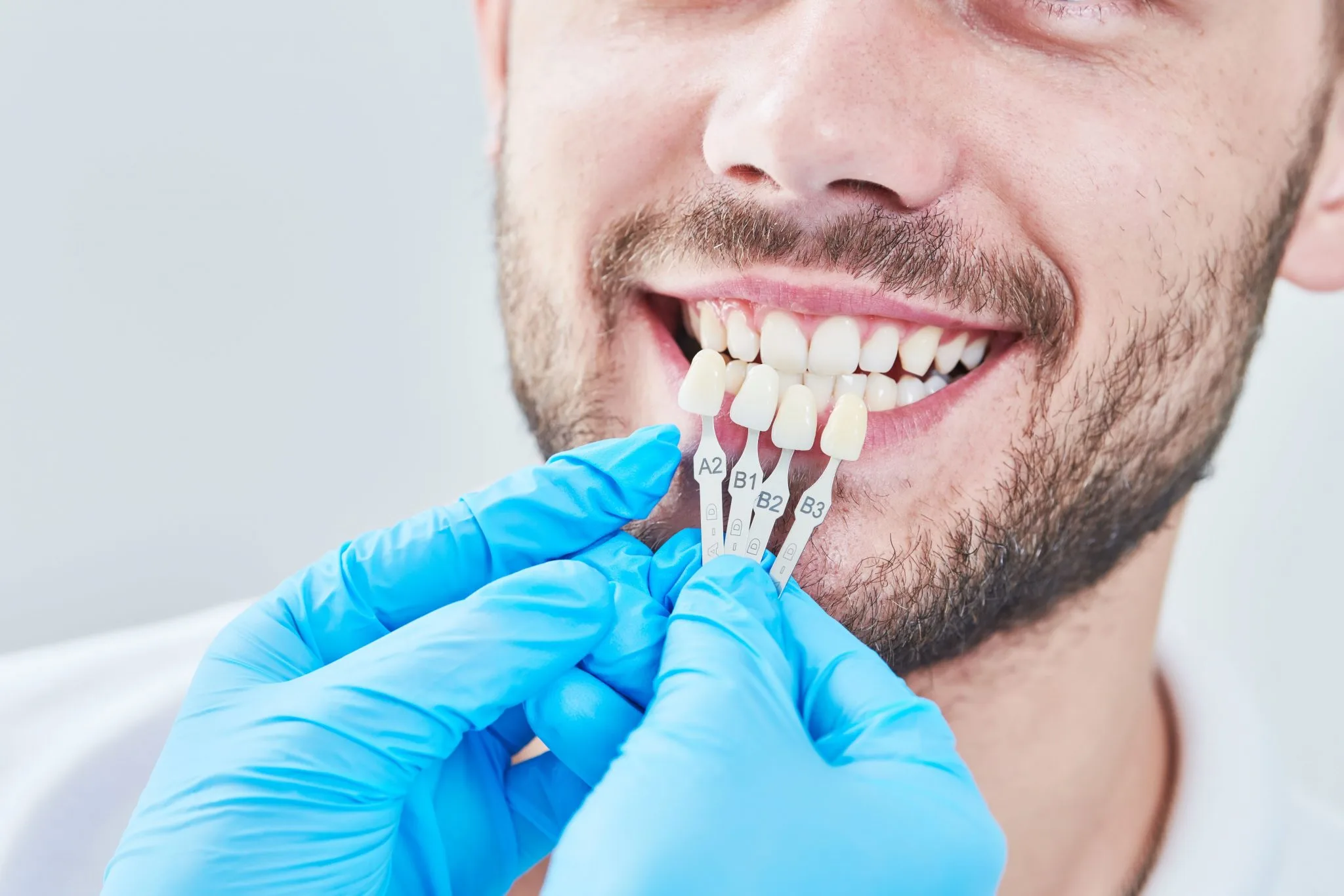 Lumineers Results: Process, Pain, Care and Veneer Comparison