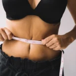 Body Contouring After Weight Loss
