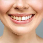 Why Molars Change Color.jpg