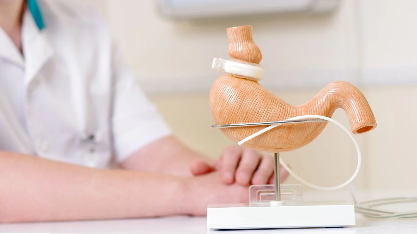 Life After Lap Band Surgery: A Guide for Patients