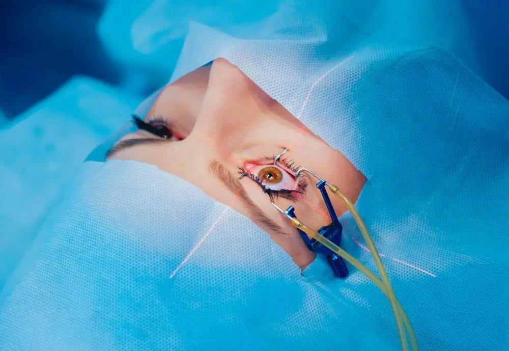 ReLEx SMILE: Procedure, Recovery, and Cost Insights in Turkey