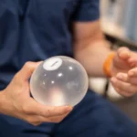 Gastric Balloon: Navigating Side Effects & Benefits
