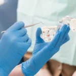 Unlocking Permanent Teeth: All-on-4 Turkey Cost