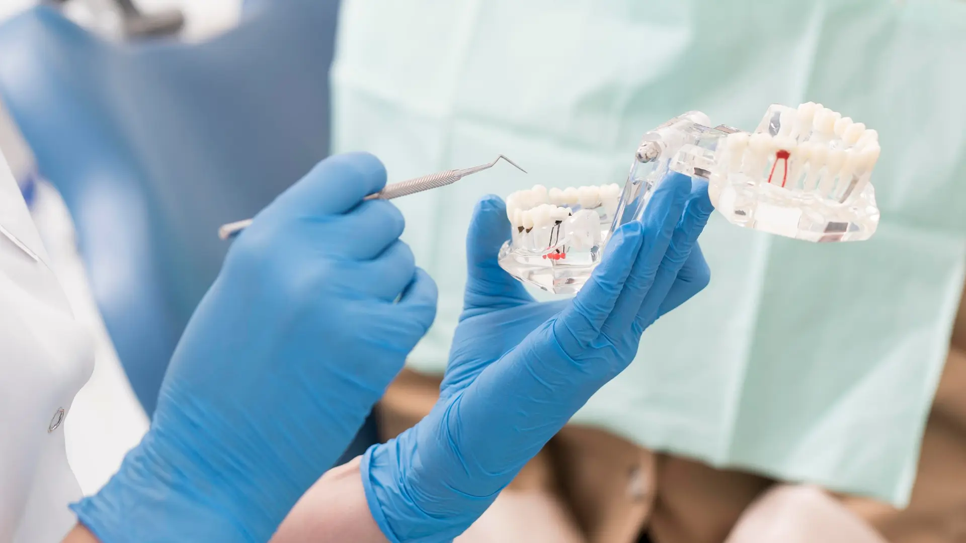 Unlocking Permanent Teeth: All-on-4 Turkey Cost
