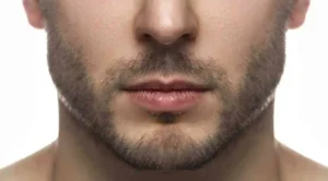 Jawline Contouring: Defining Masculine Aesthetics