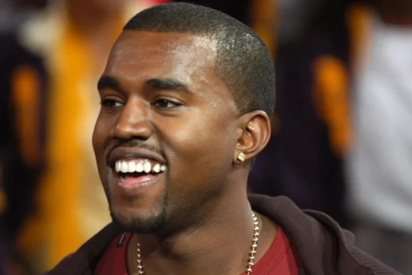 Kanye's Dental Transformation