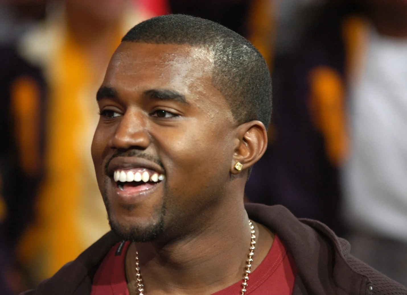 Kanye's Dental Transformation