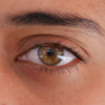 Vision Correction: Understanding LASIK Surgery Cost