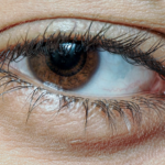 Blepharoplasty: Expert Insights for Eye Rejuvenation
