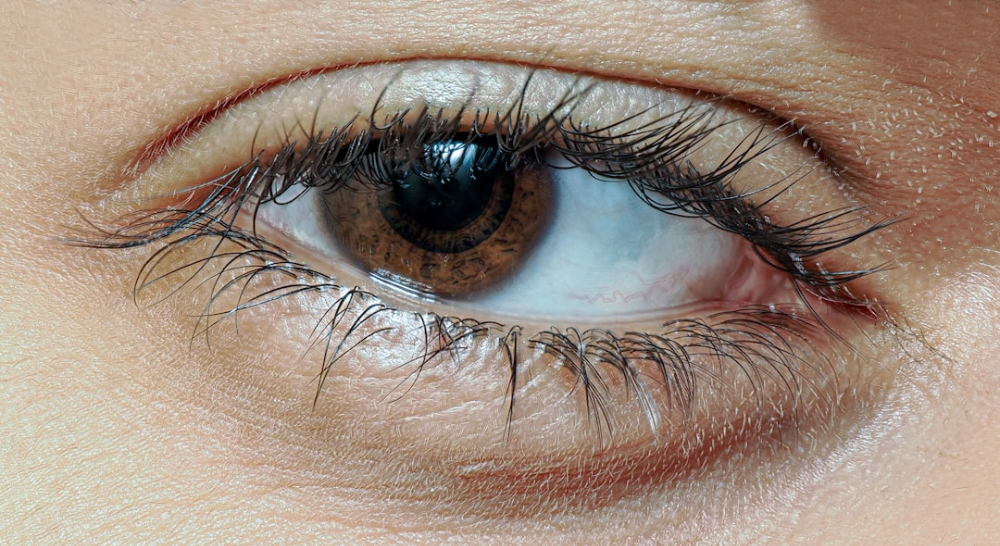 Blepharoplasty: Expert Insights for Eye Rejuvenation
