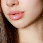 Explore lip shortening surgery, a refined aesthetic procedure. Learn about techniques, benefits, recovery, and why Turkey is a top choice for international patients.