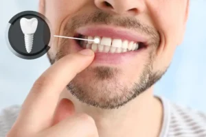 Dental Implants: Navigating Turkey Treatment Costs