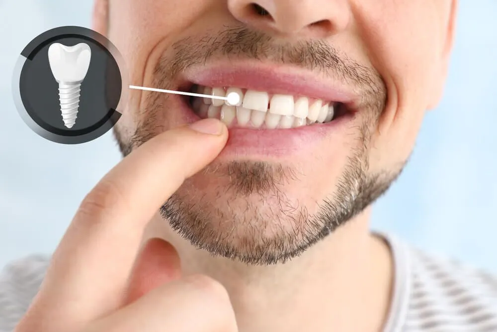 Dental Implants: Navigating Turkey Treatment Costs