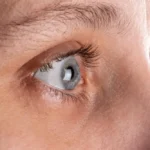 Why Would Someone Need a Cornea Transplant: Indications Explored