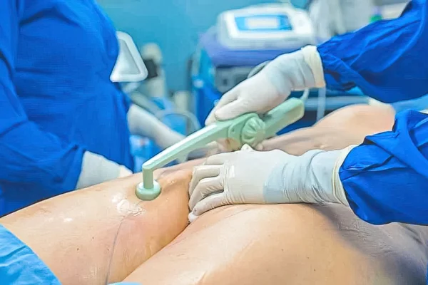 Enhanced Aesthetics: BodyTite Skin Tightening