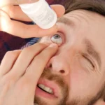 LASIK Recovery: Expert Dry Eye Treatment Strategies