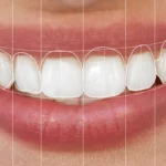 Digital Dental Design: Precision Redefined