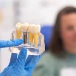 Surgery Pain: Understanding Dental Implant Discomfort