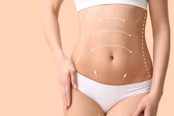 Post-Op Care: Navigating Extended Tummy Tuck Recovery