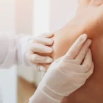 Scarless Reduction: Advanced Breast Surgery Insights