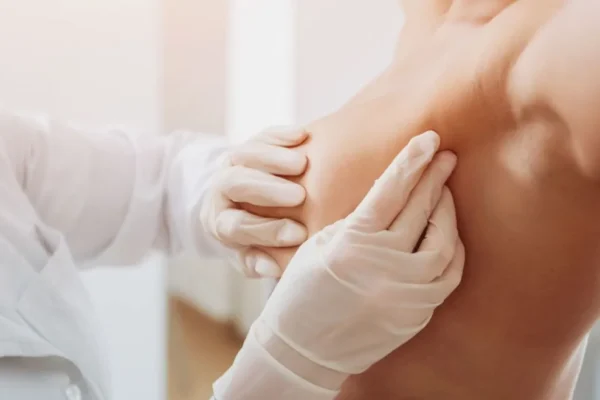 Scarless Reduction: Advanced Breast Surgery Insights