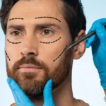 Beyond Stigma: Male Plastic Surgery Options Defined