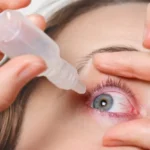 LASIK Photophobia: Causes & Management