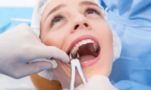 Wisdom Teeth Extraction: The Healing Journey