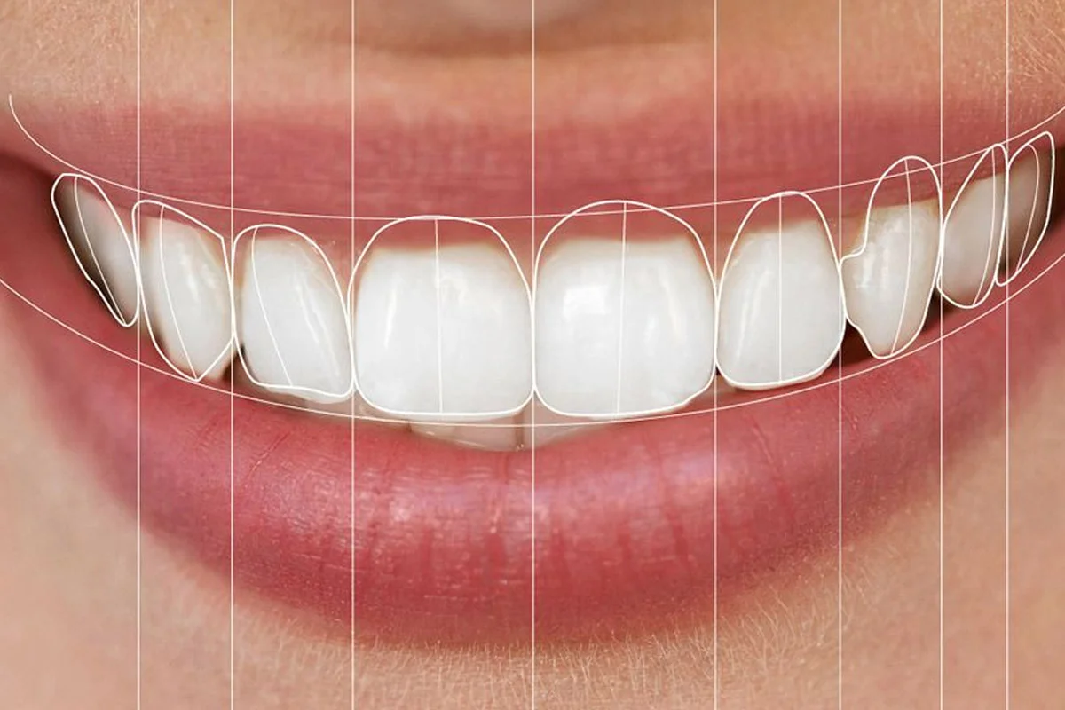 Digital Dental Design: Precision Redefined