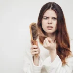 Hair Loss After Gastric Sleeve: Causes & Care
